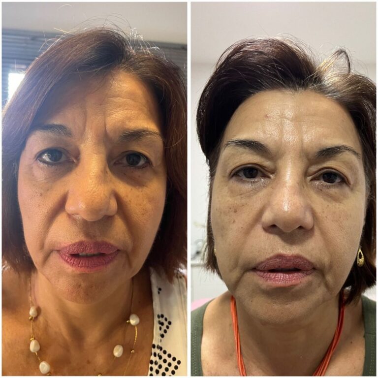 clinica-pw-rejuvenescimento