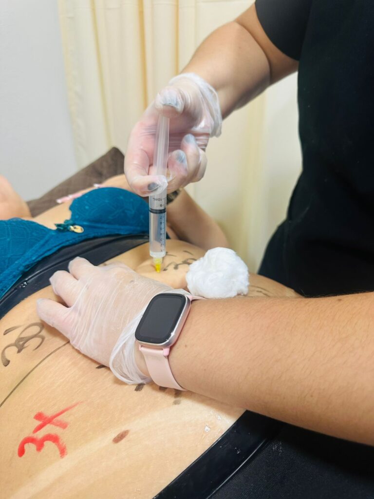 hidrolipo 2